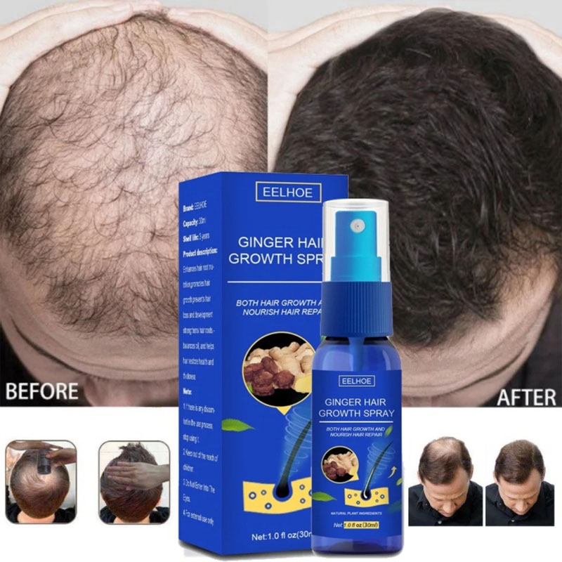 Epidermal Growth Factor - Spray do włosów imbirowy na porost