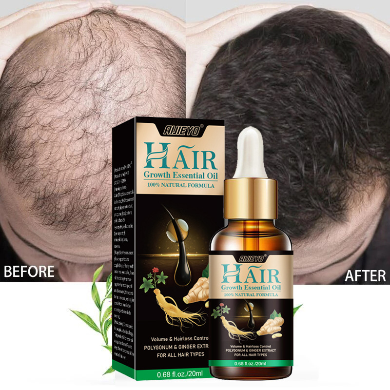Epidermal Growth Factor - 2023 biotyna szybko olejek na porost