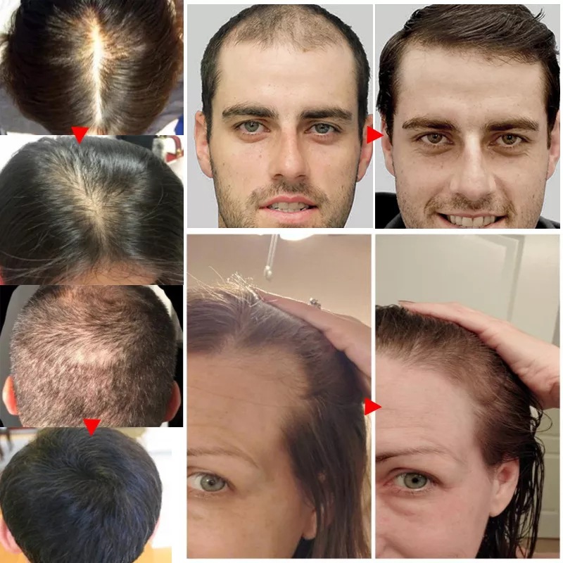 2023 biotyna szybko olejek na  – Epidermal Growth Factor recenzja i cena