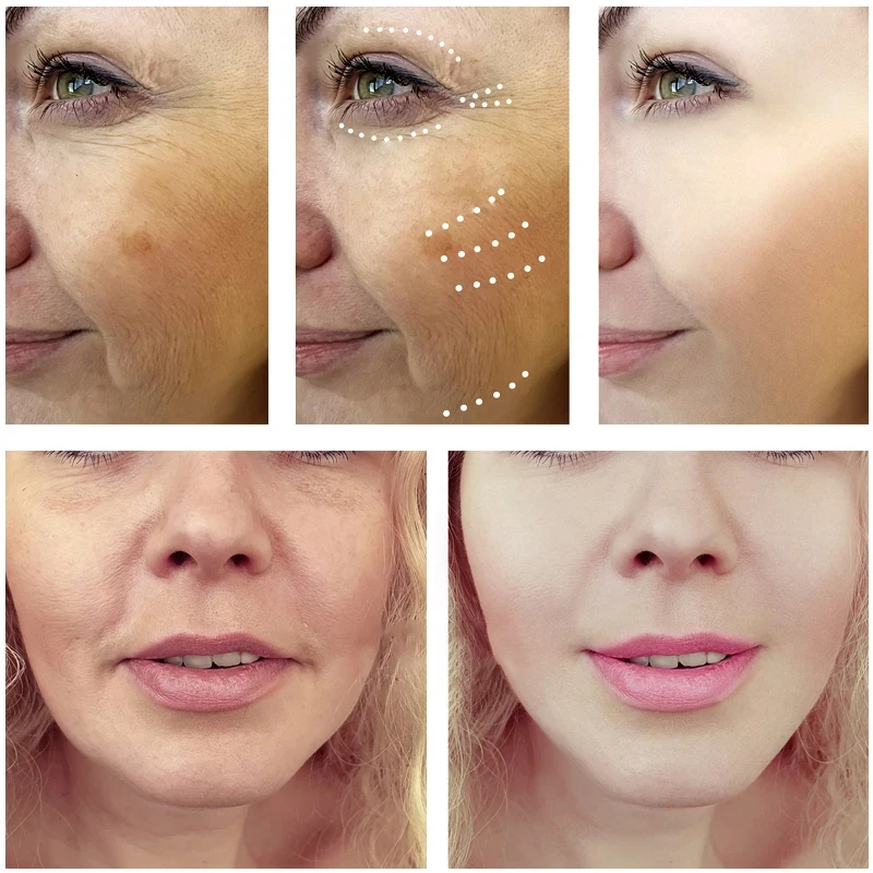 Serum krwi królewskiego smoka  – Placenta Extract Serum recenzja i cena
